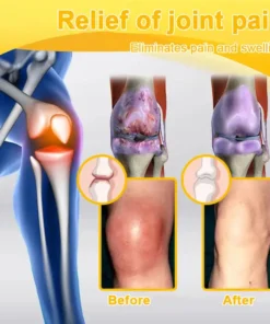 ODALIT™ Botulinum Toxin & Bee Venom Pain-Relief Bone Healing Cream 2026