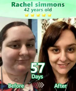 ODALIT® L-Carnitine × Retinol | Slimming & Firming 2-in-1 Nano Microneedle Patch