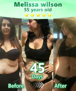 ODALIT® L-Carnitine × Retinol | Slimming & Firming 2-in-1 Nano Microneedle Patch