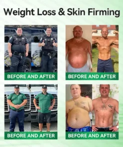 ODALIT® L-Carnitine × Retinol | Slimming & Firming 2-in-1 Nano Microneedle Patch