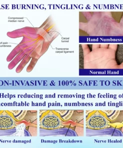 ODALIT™ NumbAway CoolEase Neuropathy Spray