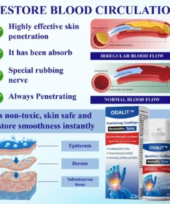 ODALIT™ NumbAway CoolEase Neuropathy Spray
