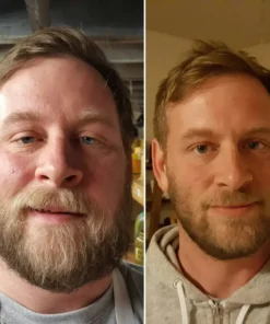 ODALIT™ Patches | Beat your alcohol cravings in just 7 days, hassle-free