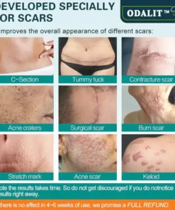 ODALIT™ Scar Spray For All Types of Scars