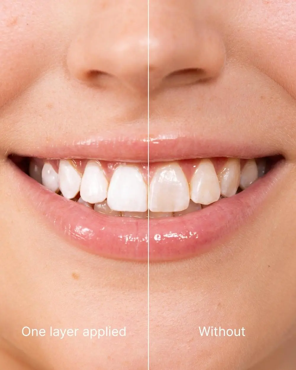 ODALIT™ Teeth Polish - Instant White Teeth