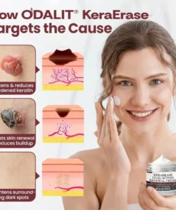 ODALIT®KeraErase Dual-Action Renewal Cream