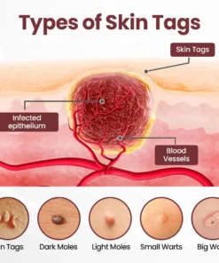 ODALIT®KeraErase Dual-Action Renewal Cream