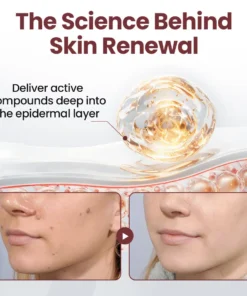 ODALIT®KeraErase Dual-Action Renewal Cream