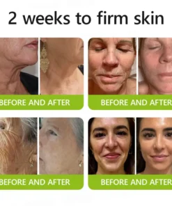 ODALIT™ Botox & Retinol Shot - Eraser for Deep Wrinkles, Sagging Jowls & Puffy Eyes