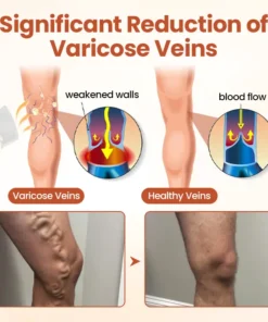ODALIT™ VeinTarget Microneedle Patch