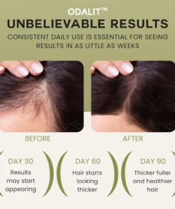 ODALIT™ Wonder Growth Oil