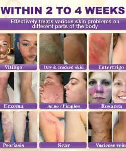 ODALIT® Biotin 10-in-1 Skin Restoration Cream