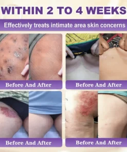 ODALIT® Biotin 10-in-1 Skin Restoration Cream