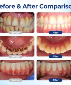 ODALIT™ Oral Repair – Fix Gums & Stop Sensitivity Fast