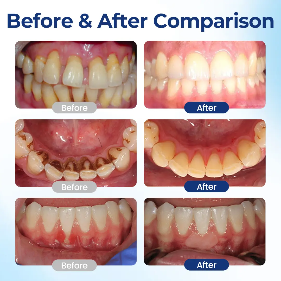 ODALIT™ Oral Repair – Fix Gums & Stop Sensitivity Fast