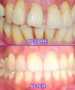 ODALIT™ SensiGum Fluoride Toothpaste