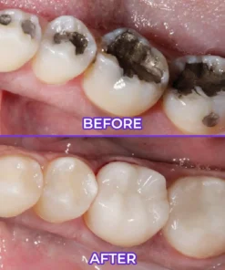 ODALIT™ SensiGum Fluoride Toothpaste