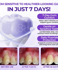 ODALIT™ SensiGum Fluoride Toothpaste