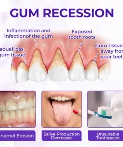 ODALIT™ SensiGum Fluoride Toothpaste