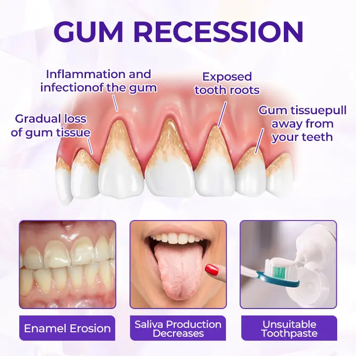 ODALIT™ SensiGum Fluoride Toothpaste