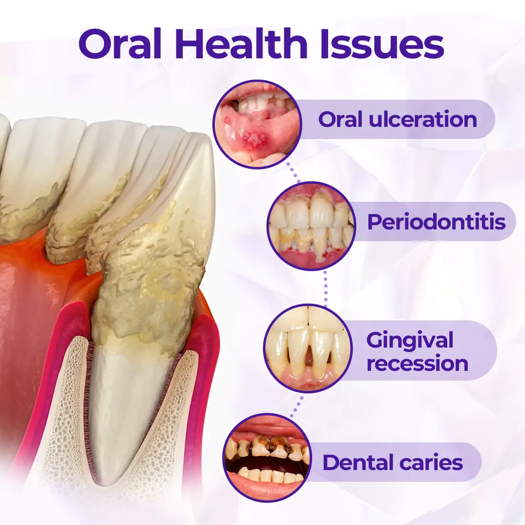 ODALIT™ SensiGum Fluoride Toothpaste